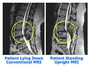 upright_mri_comparison | Amber Diagnostics